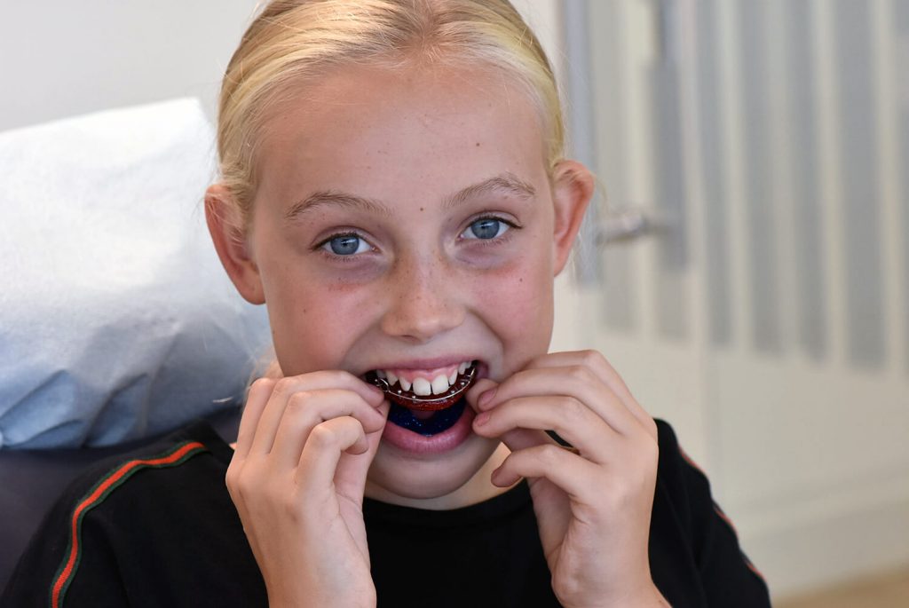 Kind met bionator — orthodontie Maaseik