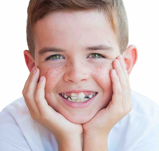 Kind met expansiebeugel — orthodontie Maaseik